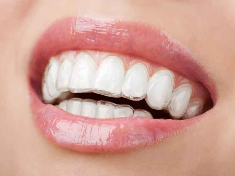 Female Tooth