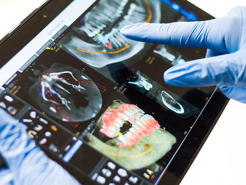 Dental Scans