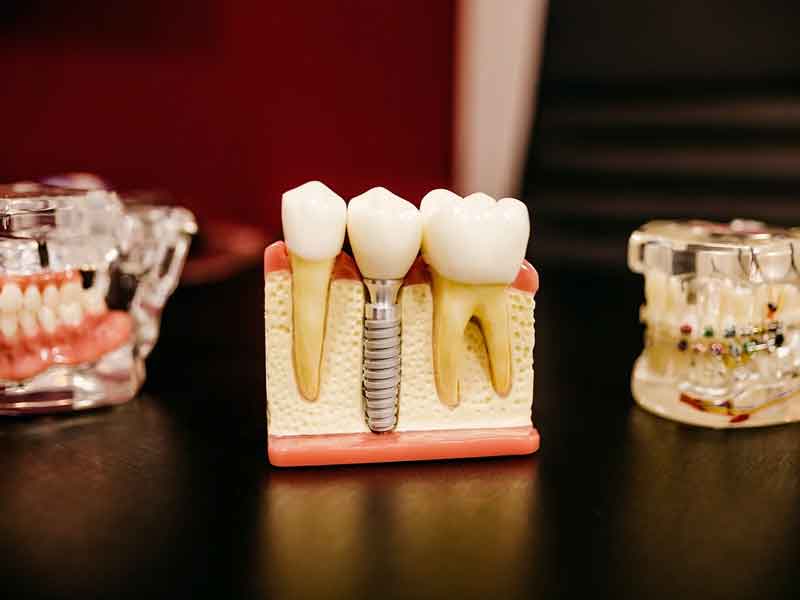 Dental Dummy
