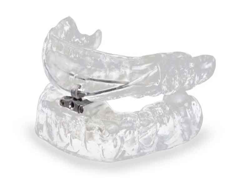 Braces