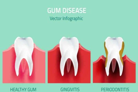 Vector Infographic